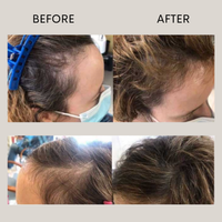before and after comparison showing fuller hair after using the Ovaco Biorepair Scalp Ampoule