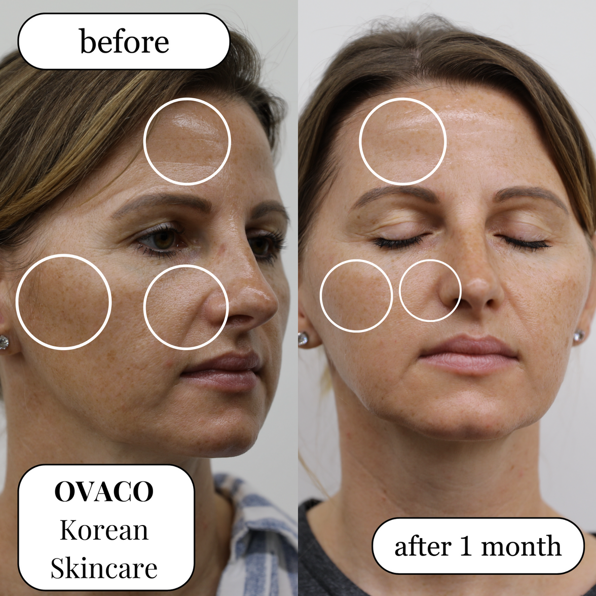 Before and after comparison image of a woman's face after using the Ovaco Egg BP Cell Set