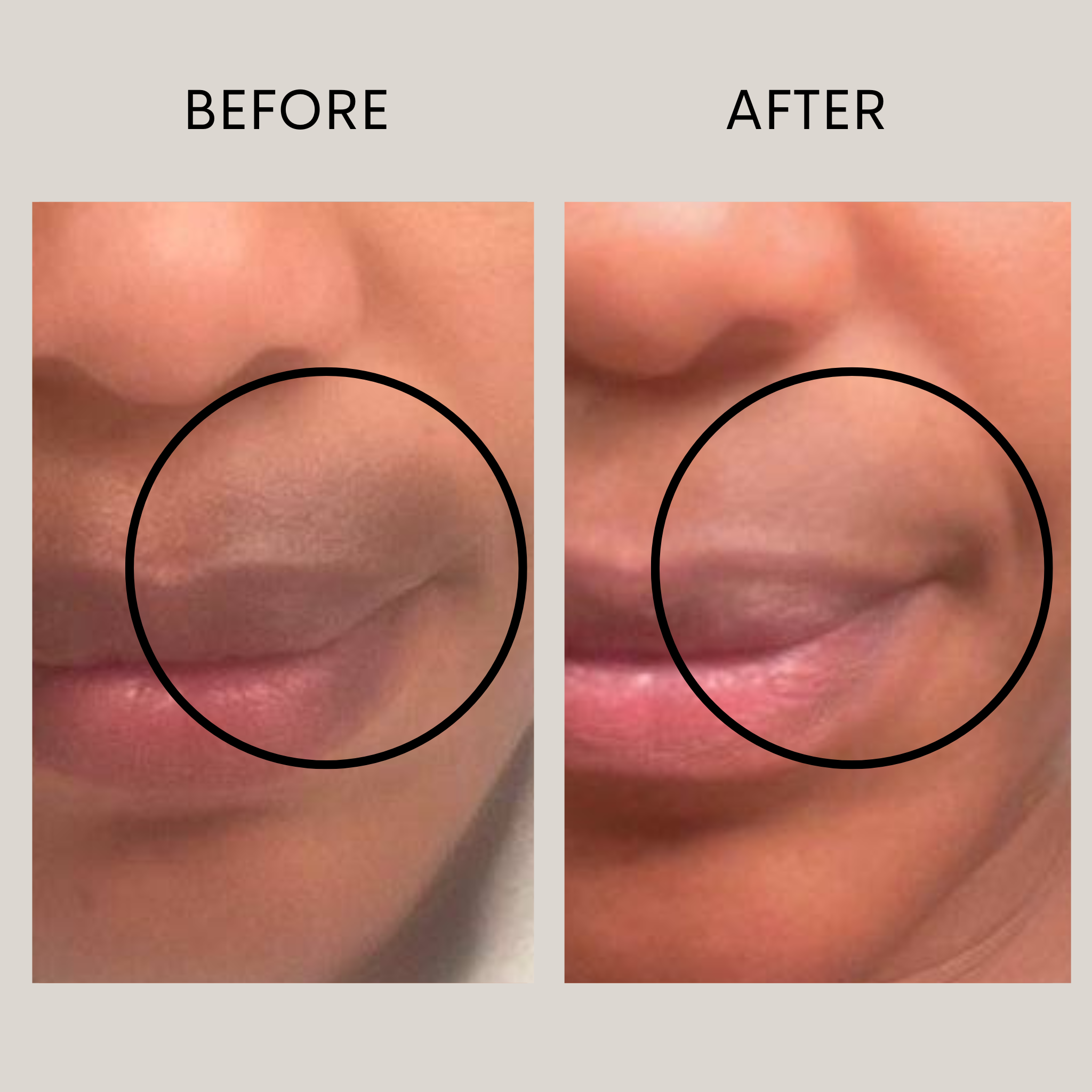 Egg BP Stem Cell Set (20% Off, full price $315)