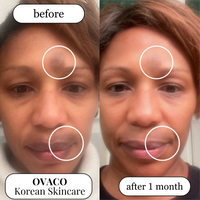 egg bp set before and after2.png__PID:ea2e58ca-5e63-4289-8718-457706e69b17