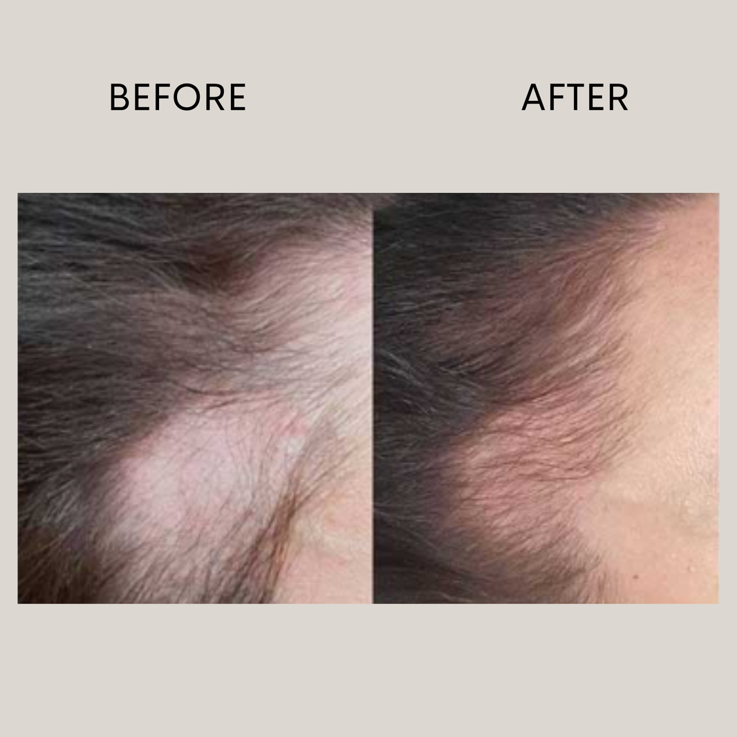 Biorepair Egg Stem Cell Scalp Ampoule (set of 3 / One month supply)